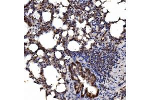 IHC analysis of delta 1 Catenin/CAS/CTNND1 using anti-delta 1 Catenin/CAS/CTNND1 antibody (ABIN7602221).