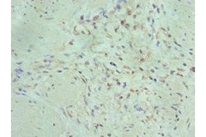 Immunohistochemistry of paraffin-embedded human gallbladder tissue using ABIN7150716 at dilution of 1:100 (MAP2K5 抗体  (AA 1-190))