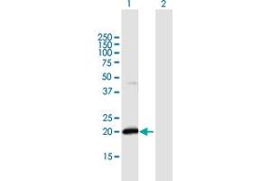 Western Blot analysis of IFNA21 expression in transfected 293T cell line by IFNA21 MaxPab polyclonal antibody. (IFNA21 抗体  (AA 1-189))