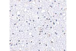Immunohistochemistry of DARC in human brain tissue with DARC antibody at 5 μg/ml. (DARC 抗体  (N-Term))