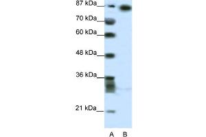 WB Suggested Anti-MYNN Antibody Titration:  2. (Myoneurin 抗体  (Middle Region))