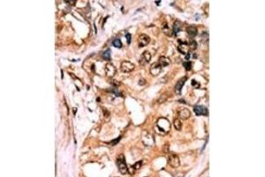 Image no. 2 for anti-Mitogen-Activated Protein Kinase Kinase 1 (MAP2K1) (pSer217), (pSer221) antibody (ABIN358157)