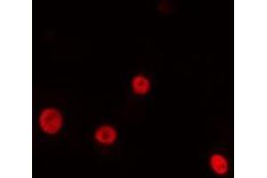 ABIN6275195 staining HeLa cells by IF/ICC. (NK2 Homeobox 4 抗体  (Internal Region))