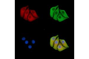 ABIN7096416 and ABIN7100480 staining Hela cells by IF/ICC.