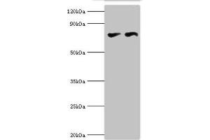 Western blot All lanes: Transcriptional repressor CTCF antibody at 6 μg/mL Lane 1: PC-3 whole cell lysate Lane 2: MCF-7 whole cell lysate Secondary Goat polyclonal to rabbit IgG at 1/10000 dilution Predicted band size: 83, 46 kDa Observed band size: 83 kDa (CTCF 抗体  (AA 1-260))