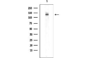 anti-Smg-7 Homolog, Nonsense Mediated mRNA Decay Factor (SMG7) (Internal Region) antibody