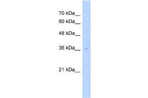WB Suggested Anti-TRUB2 Antibody Titration:  2. (TRUB2 抗体  (Middle Region))