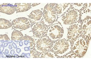 Immunohistochemical analysis of paraffin-embedded mouse testis tissue. (SMAD4 抗体  (AA 40-120))