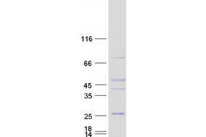 Western Blotting (WB) image for GRB2-Binding Adaptor Protein, Transmembrane (GAPT) protein (Myc-DYKDDDDK Tag) (ABIN2722228)