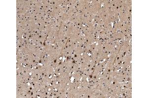 IHC analysis of Serum Response Factor/SRF using anti-Serum Response Factor/SRF antibody (ABIN7600144).