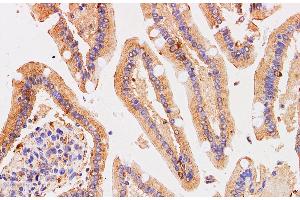 Immunohistochemistry of paraffin-embedded Human duodenum using Chromogranin A Polyclonal Antibody at dilution of 1:200 (Chromogranin A 抗体)