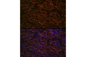 Immunofluorescence (IF) image for anti-Cytochrome P450, Family 26, Subfamily A, Polypeptide 1 (CYP26A1) antibody (ABIN7266654)