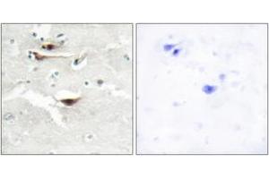 Immunohistochemistry (IHC) image for anti-Inositol 1,3,4,5,6-Pentakisphosphate 2-Kinase (IPPK) (AA 11-60) antibody (ABIN2889764) (IPPK 抗体  (AA 11-60))