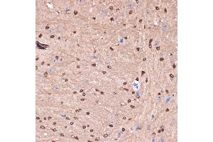 Immunohistochemistry of paraffin-embedded mouse brain using Carbonic Anhydrase 2 (C) Rabbit mAb (ABIN7266070) at dilution of 1:100 (40x lens). (CA2 抗体)