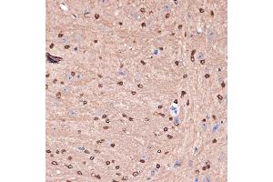 Immunohistochemistry of paraffin-embedded mouse brain using Carbonic Anhydrase 2 (C) Rabbit mAb (ABIN7266070) at dilution of 1:100 (40x lens). (CA2 抗体)