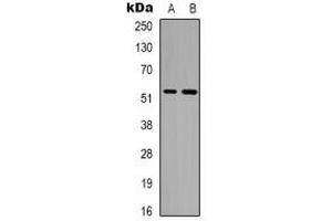 Western blot analysis of Alpha-tubulin (AcK352) expression in A549 (A), Jurkat (B) whole cell lysates. (alpha Tubulin 抗体  (acLys352))