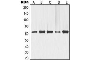 Western blot analysis of p63 expression in COLO205 (A), ME180 (B), HeLa (C), LOVO (D), HT29 (E) whole cell lysates. (TCP1 alpha/CCTA 抗体  (N-Term))