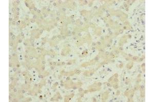 Immunohistochemistry of paraffin-embedded human liver tissue using ABIN7173949 at dilution of 1:100 (TWIST2 抗体  (AA 1-70))