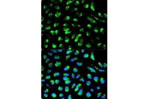 Immunofluorescence analysis of HeLa cells using ECI1 antibody.