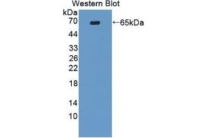 WB of Protein Standard: different control antibodies against Highly purified E. (ATG16L1 ELISA 试剂盒)
