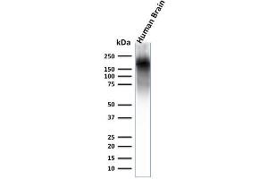 Western Blot Analysis of human brain lysate using Neurofilament Rabbit Recombinant Monoclonal Ab (NEFL. (Recombinant NEFH 抗体)