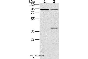 Western blot analysis of Mouse kidney and brain tissue, using CNGA3 Polyclonal Antibody at dilution of 1:500 (CNGA3 抗体)