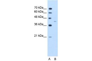 WB Suggested Anti-GNAS  Antibody Titration: 2. (GNAS 抗体  (C-Term))