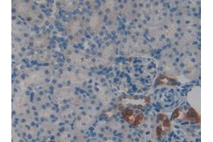Used in DAB staining on fromalin fixed paraffin- embedded kidney tissue (CSTA 抗体  (AA 1-103))