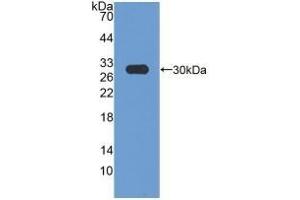 Detection of Recombinant HMGCR, Rat using Polyclonal Antibody to 3-Hydroxy-3-Methylglutaryl Coenzyme A Reductase (HMGCR) (HMGCR 抗体  (AA 638-887))