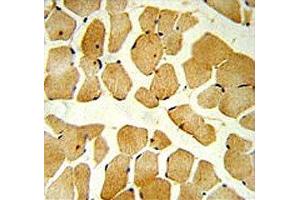 SPHK1 antibody IHC analysis in formalin fixed and paraffin embedded skeletal muscle. (SPHK1 抗体  (AA 313-343))