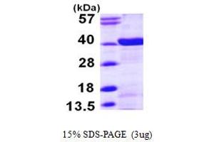 N-Myc (And STAT) Interactor (NMI) (AA 1-307) protein (His tag)