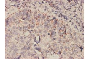 Immunostaining (ISt) image for anti-Macrophage Migration Inhibitory Factor (Glycosylation-Inhibiting Factor) (MIF) (AA 1-115) antibody (ABIN561823)