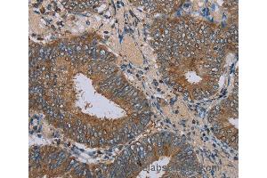 Immunohistochemistry of Human brain  using IFRD1 Polyclonal Antibody at dilution of 1:30 (IFRD1 抗体)