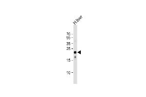 Anti-AB Antibody (Center)at 1:1000 dilution + human liver lysates Lysates/proteins at 20 μg per lane. (MMAB 抗体  (AA 50-81))