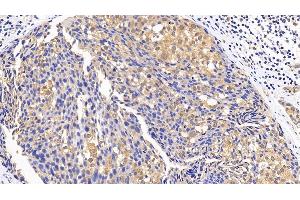 Immunohistochemistry (IHC) image for anti-Mitogen-Activated Protein Kinase 14 (MAPK14) (AA 19-279) antibody (ABIN7433252)
