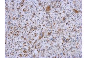 IHC-P Image Immunohistochemical analysis of paraffin-embedded C2C12 xenograft, using MMACHC, antibody at 1:500 dilution.