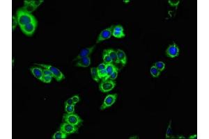 Immunofluorescent analysis of HepG2 cells using ABIN7146837 at dilution of 1:100 and Alexa Fluor 488-congugated AffiniPure Goat Anti-Rabbit IgG(H+L) (CPT1B 抗体  (AA 165-318))