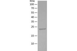 Cytokeratin 13 Protein (AA 279-458) (His tag)