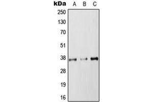 Western blot analysis of RAB36 expression in HEK293T (A), NIH3T3 (B), PC12 (C) whole cell lysates. (RAB36 抗体  (Center))