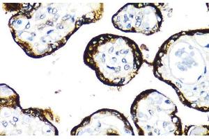 Immunohistochemistry of paraffin-embedded Human placenta using FGFR2 Polyclonal Antibody at dilution of 1:100 (40x lens). (FGFR2 抗体)