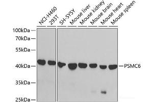 Western blot analysis of extracts of various cell lines using PSMC6 Polyclonal Antibody at dilution of 1:1000. (PSMC6 抗体)