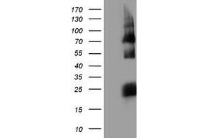 Western Blotting (WB) image for anti-Histidyl-tRNA Synthetase 2, Mitochondrial (Putative) (HARS2) antibody (ABIN1498585) (HARS2 抗体)