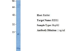 Host: Rabbit Target Name: RBX1 Sample Type: Human HepG2 Antibody Dilution: 1. (RBX1 抗体  (Middle Region))