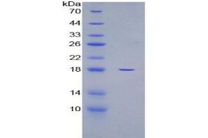 SDS-PAGE of Protein Standard from the Kit (Highly purified E. (GAPDH CLIA Kit)