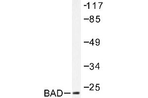 Image no. 1 for anti-BCL2-Associated Agonist of Cell Death (BAD) antibody (ABIN271900) (BAD 抗体)