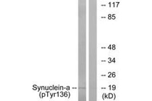 Western blot analysis of extracts from mouse brain, using Synuclein-alpha (Phospho-Tyr136) Antibody. (SNCA 抗体  (pTyr136))