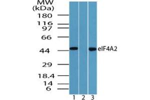 Image no. 2 for anti-Eukaryotic Translation Initiation Factor 4A2 (EIF4A2) (AA 1-50) antibody (ABIN960157) (EIF4A2 抗体  (AA 1-50))