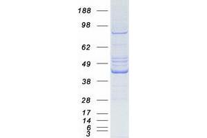 Western Blotting (WB) image for 2',5'-Oligoadenylate Synthetase 1, 40/46kDa (OAS1) (Transcript Variant 2) protein (Myc-DYKDDDDK Tag) (ABIN2727845)