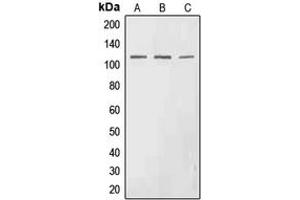 Western blot analysis of EPHA3 (pY602) expression in HEK293T (A), SP2/0 (B), H9C2 (C) whole cell lysates. (EPH Receptor A3 抗体  (pTyr602))
