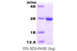 SDS-PAGE (SDS) image for O6-Methylguanine-DNA-Methyltransferase (MGMT) (AA 1-207) protein (His tag) (ABIN666723) (MGMT Protein (AA 1-207) (His tag))